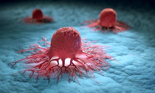 راه های تشخیص سرطان پروستات چیست؟